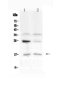 Invitrogen IL1F10 Polyclonal Antibody 100 &mu;g; Unconjugated:Antibodies,