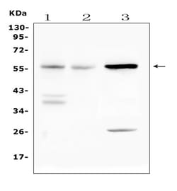 Invitrogen IL23R Polyclonal Antibody 100 &mu;g | Buy Online | Invitrogen&trade; | Fisher Scientific