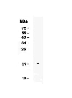 Invitrogen IL-25 Polyclonal Antibody 100 &mu;g; Unconjugated:Antibodies,