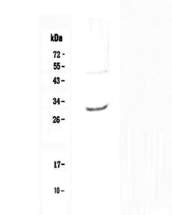 Invitrogen IL-27 p28 Polyclonal Antibody 100 &mu;g; Unconjugated:Antibodies,
