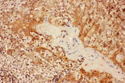 Invitrogen CD25 Polyclonal Antibody 100 &mu;g; Unconjugated:Antibodies,