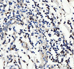 Invitrogen CD25 Polyclonal Antibody 100 &mu;g; Unconjugated:Antibodies,