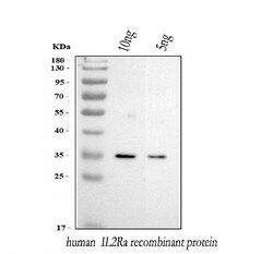Invitrogen CD25 Polyclonal Antibody 100 &mu;g; Unconjugated:Antibodies,