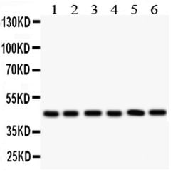Invitrogen CD25 Polyclonal Antibody 100 &mu;g; Unconjugated:Antibodies,
