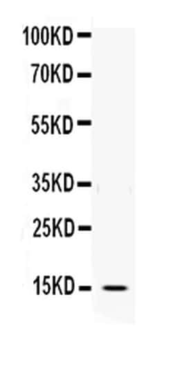 Invitrogen IL-3 Polyclonal Antibody 100 &mu;g | Buy Online | Invitrogen&trade; | Fisher Scientific