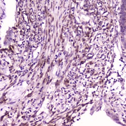 Invitrogen IL1F6 Polyclonal Antibody 100 &mu;g; Unconjugated:Antibodies,