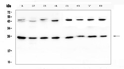 Invitrogen IL1F6 Polyclonal Antibody 100 &mu;g; Unconjugated:Antibodies,