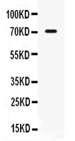 Invitrogen CD127 Polyclonal Antibody 100 &mu;g; Unconjugated:Antibodies,