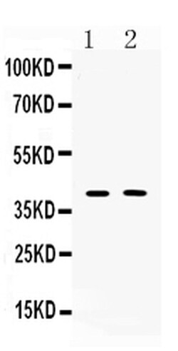 Invitrogen ISL1 Polyclonal Antibody 100 μg; Unconjugated:Antibodies,