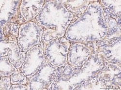 Invitrogen CD49a (Integrin alpha 1) Polyclonal Antibody 100 &mu;g; Unconjugated:Antibodies,