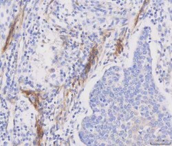 Invitrogen CD49a (Integrin alpha 1) Polyclonal Antibody 100 &mu;g; Unconjugated:Antibodies,