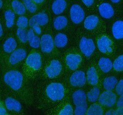 Invitrogen CD49c (Integrin alpha 3) Polyclonal Antibody 100 &mu;g; Unconjugated:Antibodies,