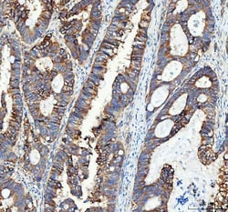 Invitrogen CD49c (Integrin alpha 3) Polyclonal Antibody 100 &mu;g; Unconjugated:Antibodies,