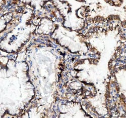 Invitrogen CD49c (Integrin alpha 3) Polyclonal Antibody 100 &mu;g; Unconjugated:Antibodies,