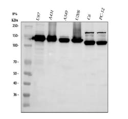 Invitrogen CD49c (Integrin alpha 3) Polyclonal Antibody 100 &mu;g; Unconjugated:Antibodies,