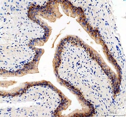Invitrogen CD49e (Integrin alpha 5) Polyclonal Antibody 100 &mu;g | Buy Online | Invitrogen&trade; | Fisher Scientific
