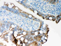 Invitrogen ITPR3 Polyclonal Antibody 100 &mu;g; Unconjugated:Antibodies,
