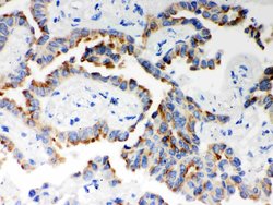 Invitrogen ITPR3 Polyclonal Antibody 100 &mu;g; Unconjugated:Antibodies,