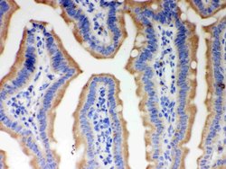 Invitrogen ITPR3 Polyclonal Antibody 100 &mu;g; Unconjugated:Antibodies,