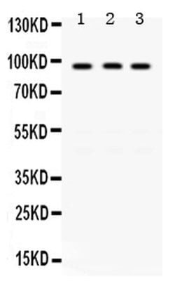 Invitrogen GCN5 Polyclonal Antibody 100 &mu;g; Unconjugated:Antibodies,