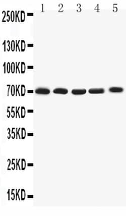Invitrogen KV1.4 (KCNA4) Polyclonal Antibody 100 &mu;g | Buy Online | Invitrogen&trade; | Fisher Scientific