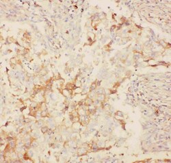 Invitrogen KV2.1 (KCNB1) Polyclonal Antibody 100 &mu;g; Unconjugated:Antibodies,