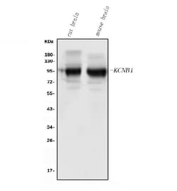 Invitrogen KV2.1 (KCNB1) Polyclonal Antibody 100 &mu;g; Unconjugated:Antibodies,