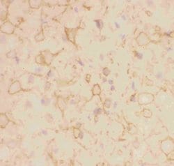 Invitrogen KV2.1 (KCNB1) Polyclonal Antibody 100 &mu;g; Unconjugated:Antibodies,