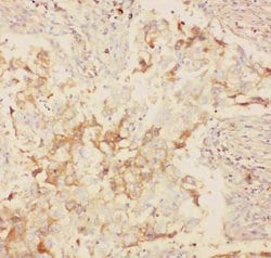 Invitrogen KV2.1 (KCNB1) Polyclonal Antibody 100 &mu;g; Unconjugated:Antibodies,