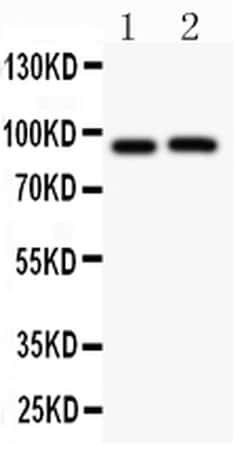 Invitrogen KV2.1 (KCNB1) Polyclonal Antibody 100 &mu;g; Unconjugated:Antibodies,
