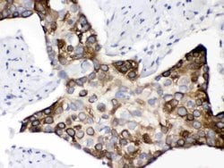 Invitrogen KIN Polyclonal Antibody 100 &mu;g; Unconjugated:Antibodies,