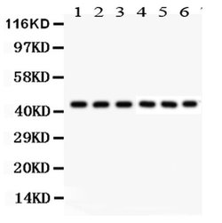 Invitrogen KIN Polyclonal Antibody 100 &mu;g; Unconjugated:Antibodies,