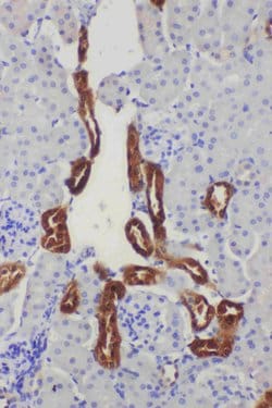 Invitrogen Kallikrein 1 Polyclonal Antibody 100 &mu;g; Unconjugated:Antibodies,