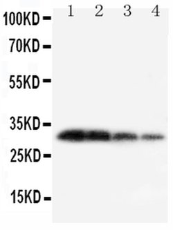 Invitrogen Kallikrein 1 Polyclonal Antibody 100 &mu;g; Unconjugated:Antibodies,