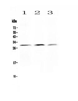 Invitrogen Kallikrein 2 Polyclonal Antibody 100 &mu;g; Unconjugated:Antibodies,