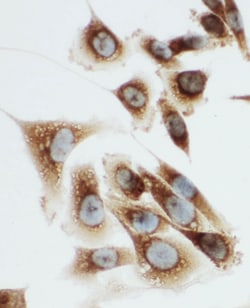 Invitrogen Kallikrein 6 Polyclonal Antibody 100 &mu;g; Unconjugated:Antibodies,