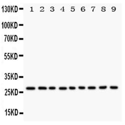 Invitrogen Kallikrein 6 Polyclonal Antibody 100 &mu;g; Unconjugated:Antibodies,