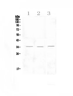 Invitrogen NKG2D (CD314) Polyclonal Antibody 100 &mu;g; Unconjugated:Antibodies,