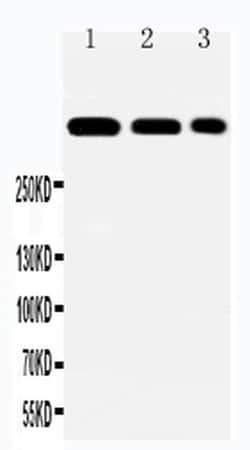 Invitrogen Laminin alpha-2 Polyclonal Antibody 100 &mu;g; Unconjugated:Antibodies,