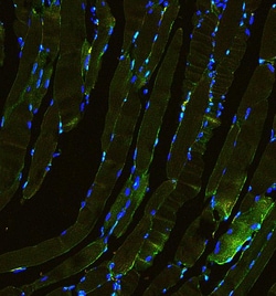 Invitrogen Laminin gamma-1,2,3 Polyclonal Antibody 100 &mu;g; Unconjugated:Antibodies,