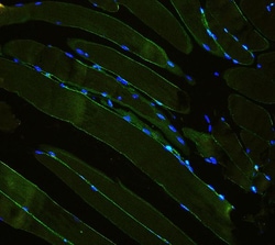 Invitrogen Laminin gamma-1,2,3 Polyclonal Antibody 100 &mu;g; Unconjugated:Antibodies,
