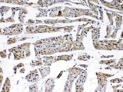 Invitrogen Laminin gamma-1,2,3 Polyclonal Antibody 100 &mu;g; Unconjugated:Antibodies,