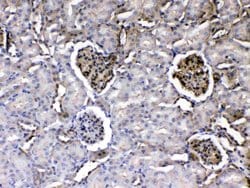 Invitrogen Laminin gamma-1,2,3 Polyclonal Antibody 100 &mu;g; Unconjugated:Antibodies,