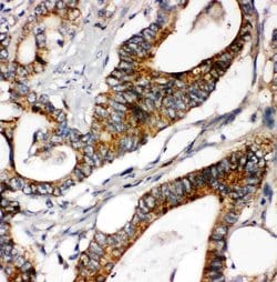 Invitrogen Laminin gamma-1 Polyclonal Antibody 100 &mu;g; Unconjugated:Antibodies,