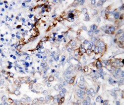 Invitrogen Laminin gamma-2 Polyclonal Antibody 100 &mu;g; Unconjugated:Antibodies,