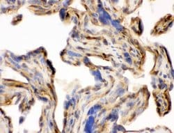 Invitrogen Laminin gamma-1,2,3 Polyclonal Antibody 100 &mu;g; Unconjugated:Antibodies,