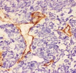 Invitrogen Laminin gamma-1,2,3 Polyclonal Antibody 100 &mu;g; Unconjugated:Antibodies,
