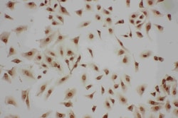 Invitrogen LASP1 Polyclonal Antibody 100 &mu;g; Unconjugated:Antibodies,