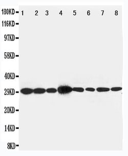 Invitrogen LASP1 Polyclonal Antibody 100 &mu;g; Unconjugated:Antibodies,