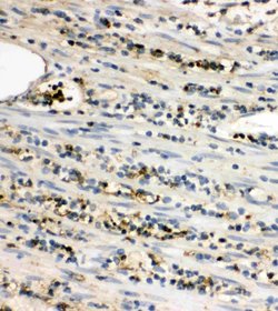 LAT Polyclonal Antibody, Invitrogen 100 &mu;g; Unconjugated:Antibodies,